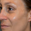 Close-up of a person's face with visible skin texture and lines.