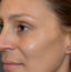Close-up of a person's face with a focus on the eye area.