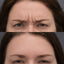 Before and after comparison of a woman's eyebrows with a neutral background.