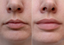 Image after