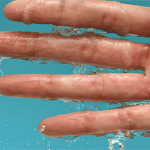 How to Stop Sweaty Clammy Hands