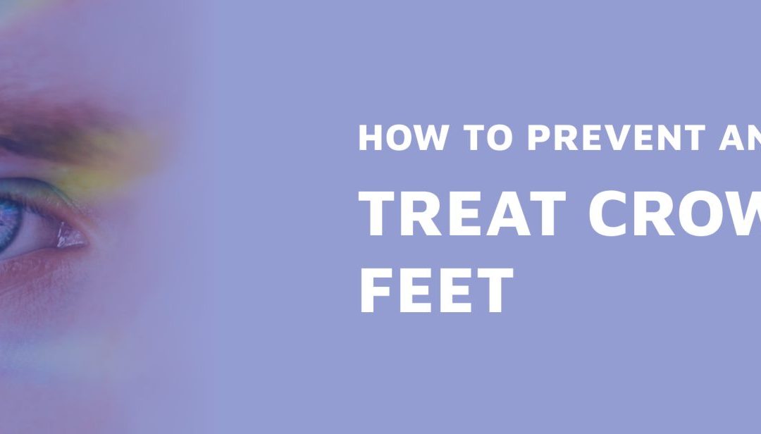 How To Prevent And Treat Crow’s Feet