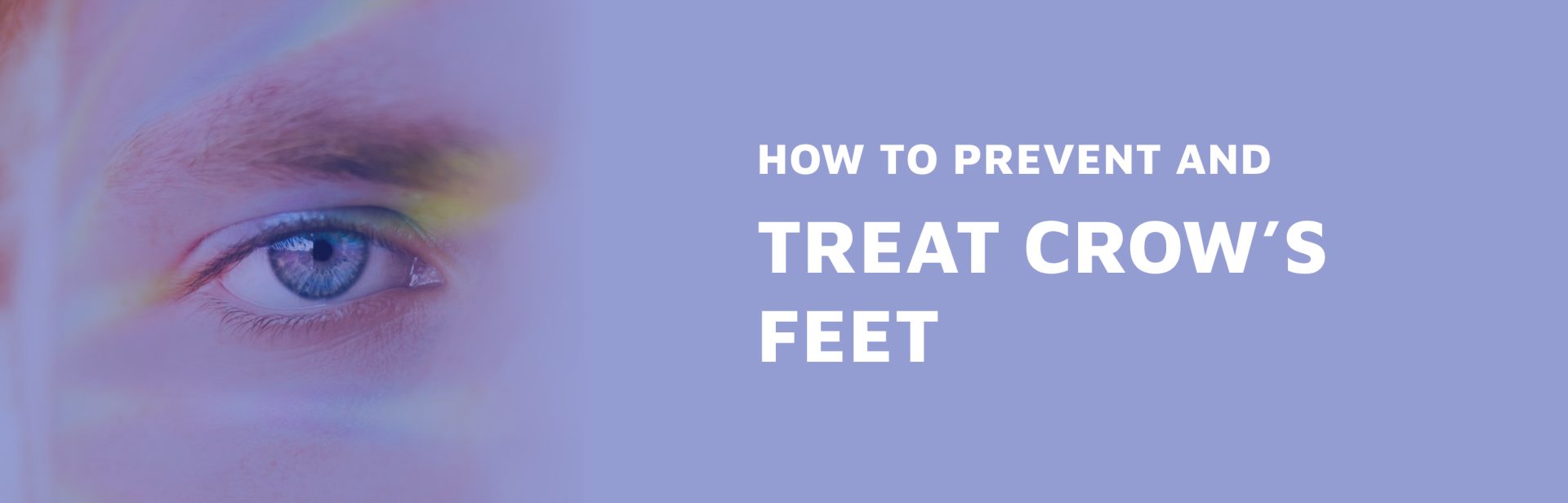 How-To-Prevent-And-Treat-Crow---s-Feet