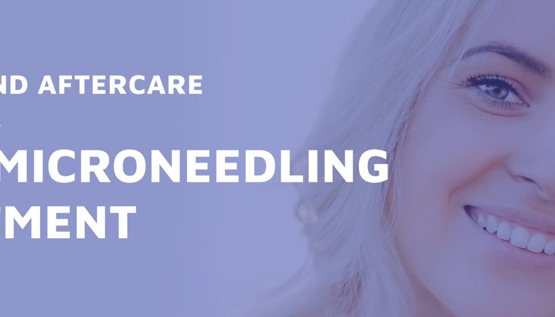 Before And Aftercare Guide For Microneedling Treatment