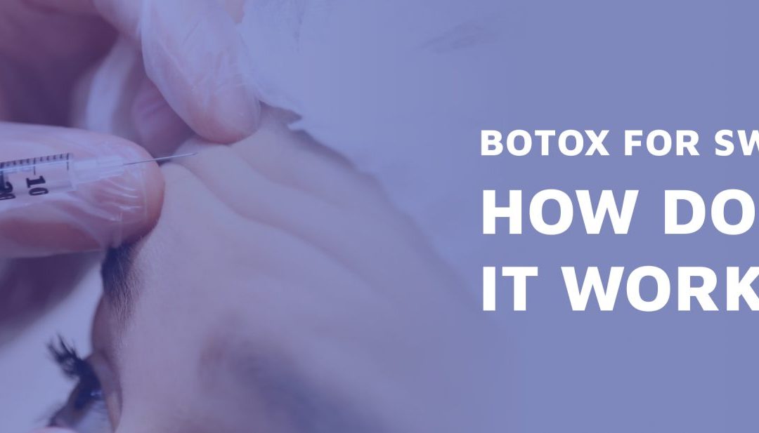 Botox For Sweating: How Does It Work?