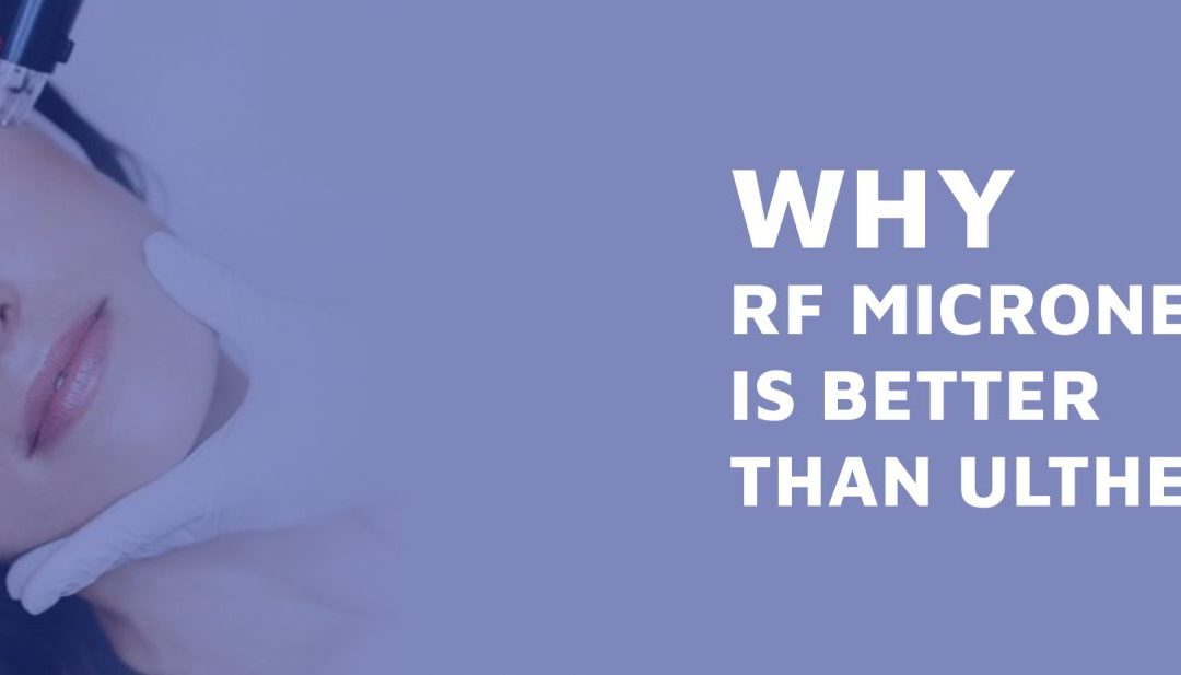 Why RF Microneedling Is Better Than Ultherapy